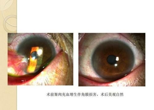 眼科